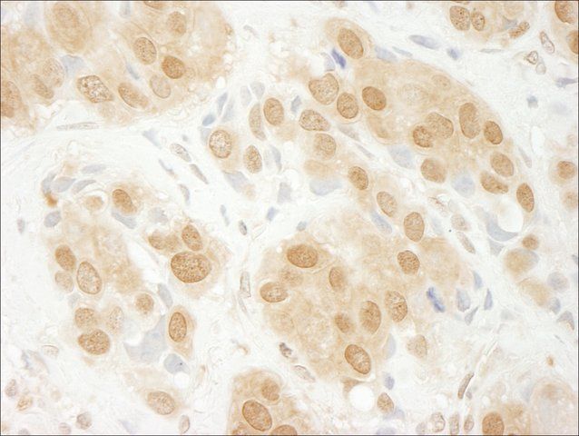 Rabbit anti-ERK1 Antibody, Affinity Purified