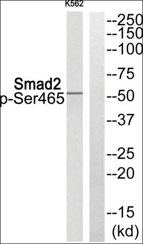 Anti-phospho-Smad2 (pSer<sup>465</sup>) antibody produced in rabbit