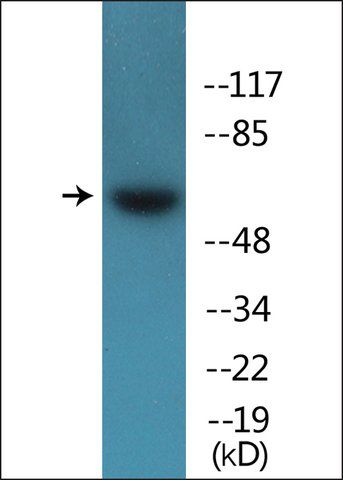 Anti-phospho-Src (pTyr<sup>418</sup>) antibody produced in rabbit