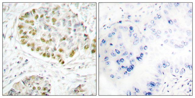 Anti-STAT5A antibody produced in rabbit