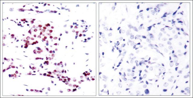 Anti-STAT5A (Ab-780) antibody produced in rabbit