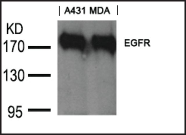 Anti-EGFR (Ab-1197) antibody produced in goat