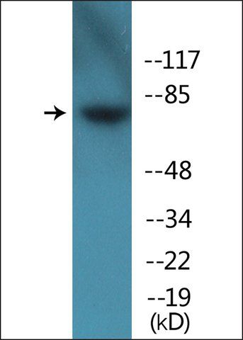 Anti-phospho-Tau (pSer<sup>262</sup>) antibody produced in rabbit