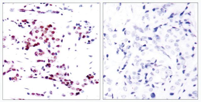 Anti-STAT5A antibody produced in rabbit