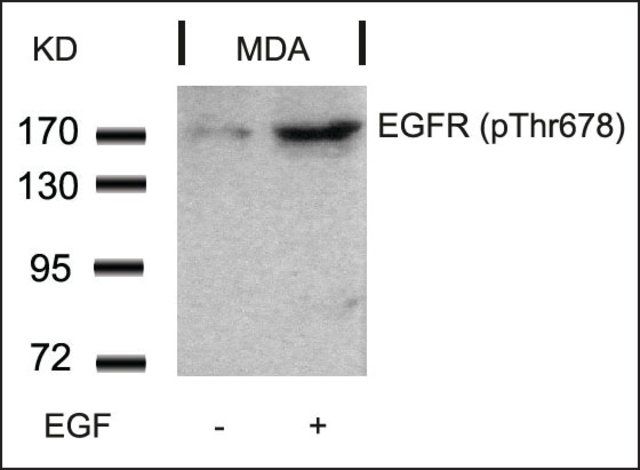 Anti-phospho-EGFR (pThr<sup>678</sup>) antibody produced in rabbit