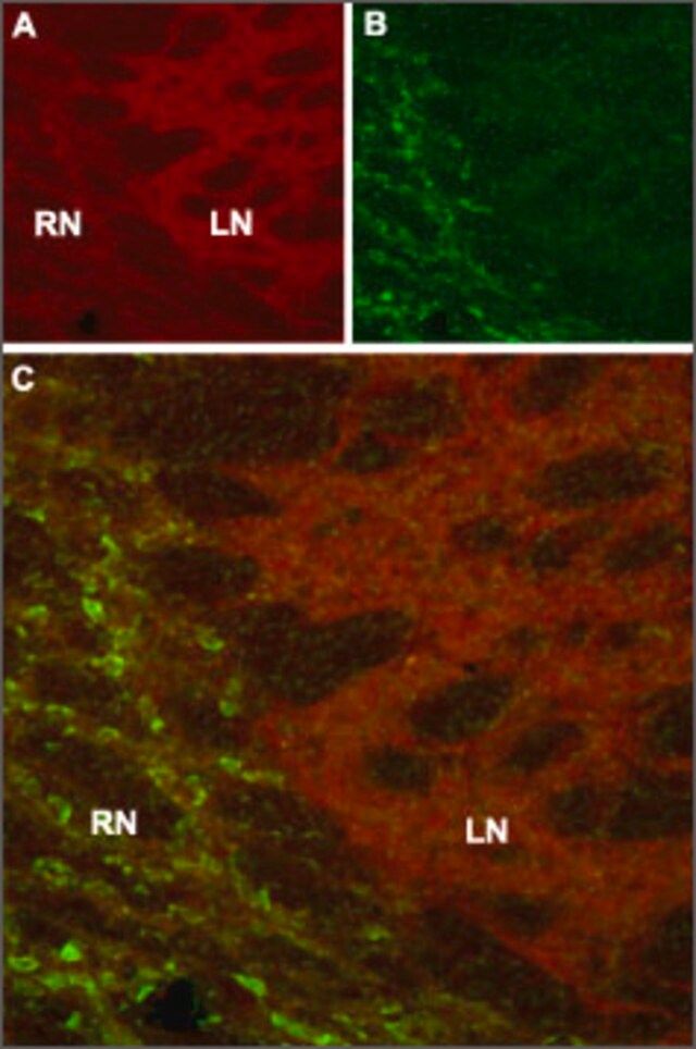 Anti-Hyperpolarization-Activated Cyclic Nucleotide-Gated Potassium Channel 4 antibody produced in rabbit