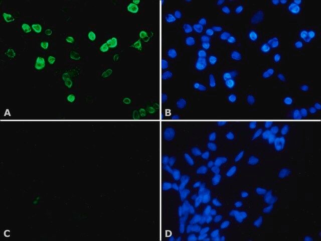 Anti-Histone Deacetylase 4 (HDAC4) (DM-15) antibody produced in rabbit