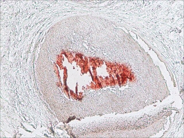 Anti-Histone Deacetylase 5 (HDAC5) (NA-16) antibody produced in rabbit