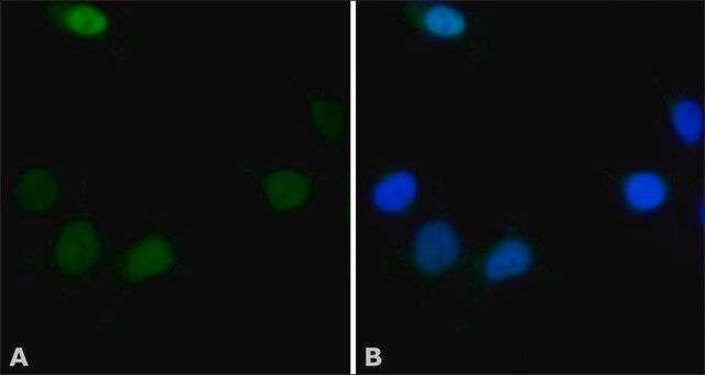 Anti-hSNF5/INI1 antibody produced in rabbit