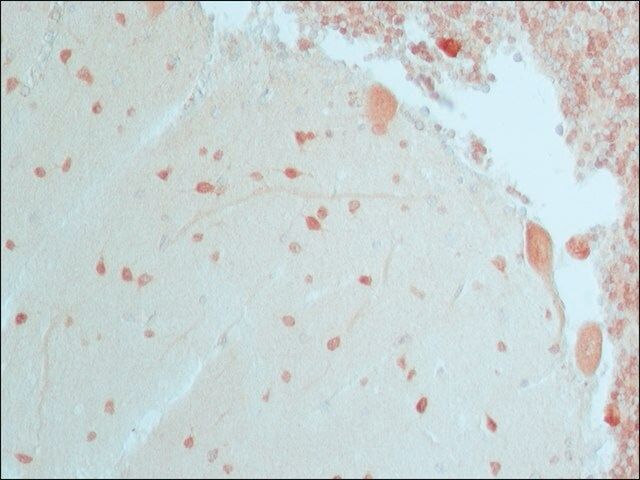 Anti-HuD antibody produced in rabbit