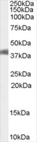 Anti-AGTR1/AT1 antibody produced in goat