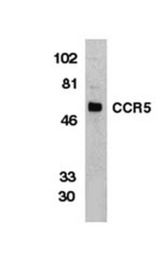 Anti-C-C Chemokine Receptor 5 Antibody, NT