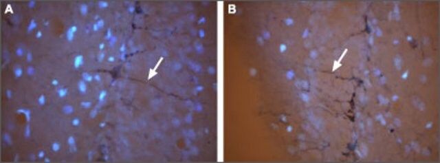 Anti-Cyclic Nucleotide-Gated Cation Channel A3 (CNGA3) antibody produced in rabbit