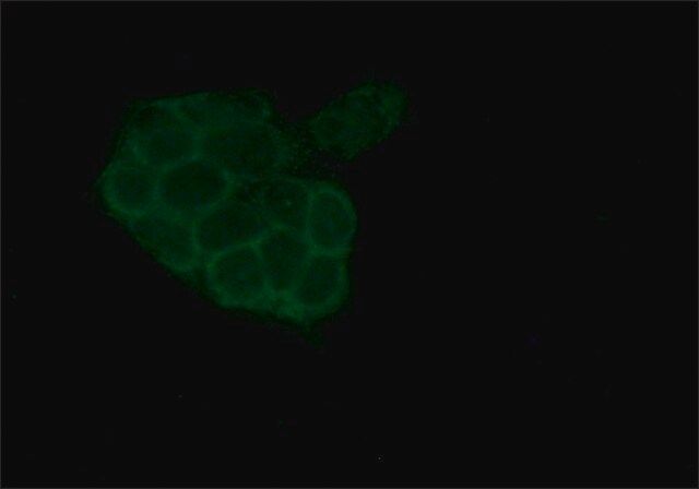 Anti--E-Catenin antibody produced in rabbit