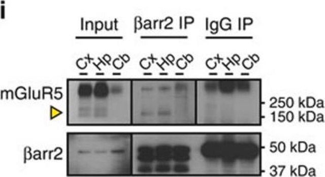 Anti-Metabotropic Glutamate Receptor 5 Antibody, pain