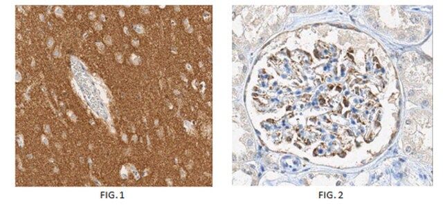 Anti-alpha-Synuclein (aa 121-125) Antibody, clone Syn211 (Ascites Free)