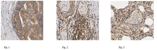 Anti-Talin 1 Antibody, clone TA205, N-Term, Ascites Free