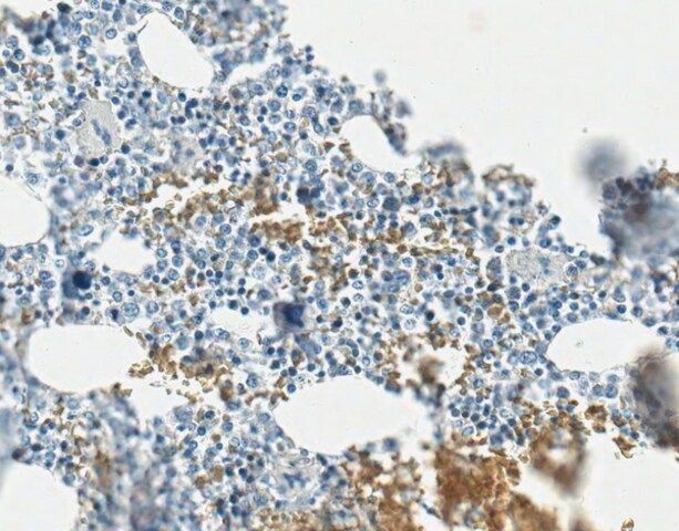 Anti-Procollagen Type I Antibody, CT, clone PCIDG10 (Ascites Free)