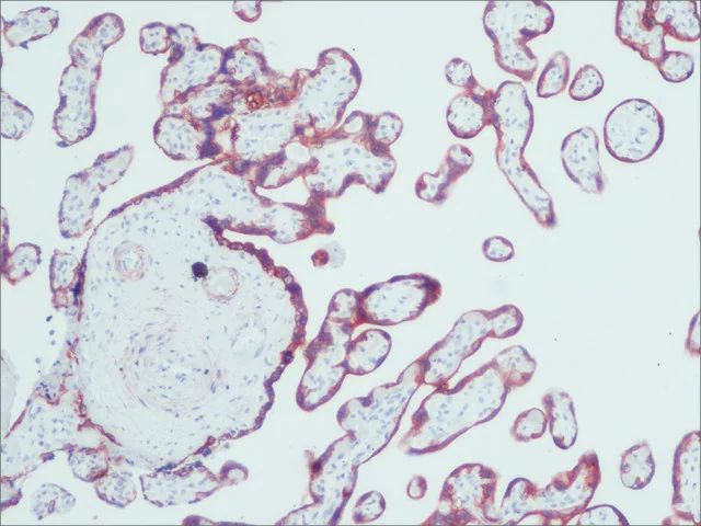 Anti-Cytokeratin, pan antibody, Mouse monoclonal antibody produced in mouse