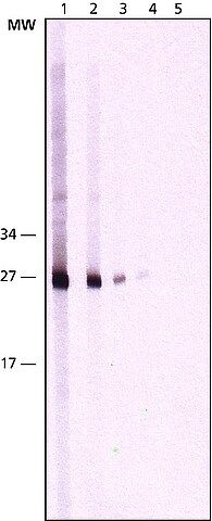 Monoclonal Anti-Cathepsin K antibody produced in mouse