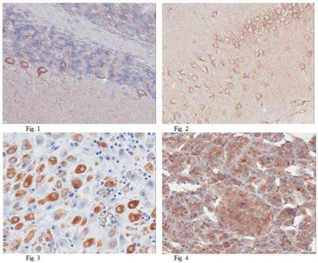 Anti-TFG Antibody