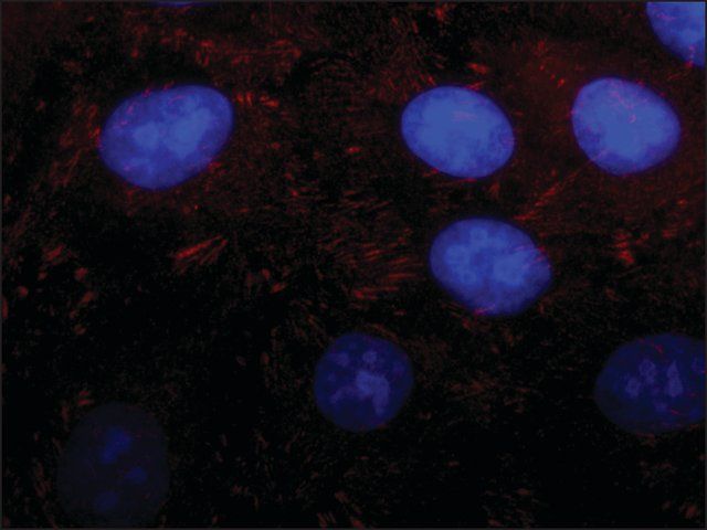 Anti-Kindlin-2 antibody produced in rabbit