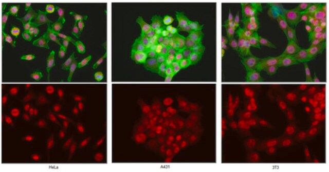 Anti-UTX Antibody