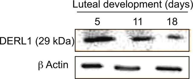 Anti-Derlin-1 antibody produced in rabbit