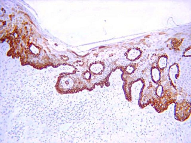 Anti-Cytokeratin 19 Antibody, clone RCK108