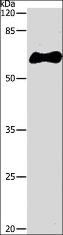 Anti-GST Tag antibody produced in rabbit