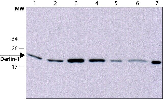 Anti-Derlin-1 antibody, Mouse monoclonal