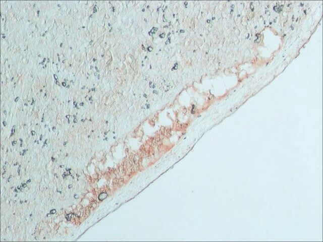 Anti-Bovine IgG (whole molecule)-Peroxidase antibody produced in rabbit