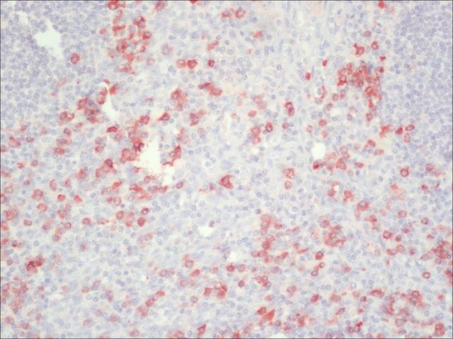 Anti-Human IgG (Fc specific)-Peroxidase antibody produced in goat