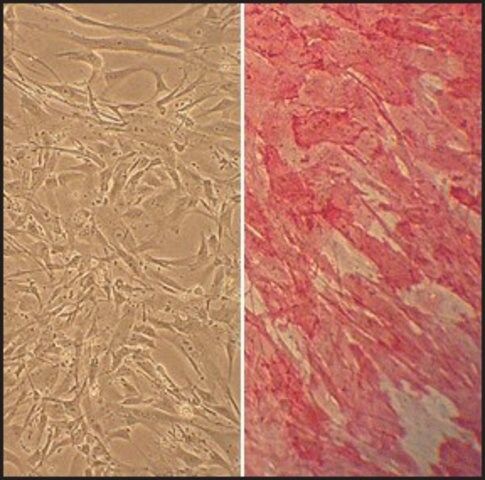 Human Carotid Artery Smooth Muscle Cells: HCtASMC, adult