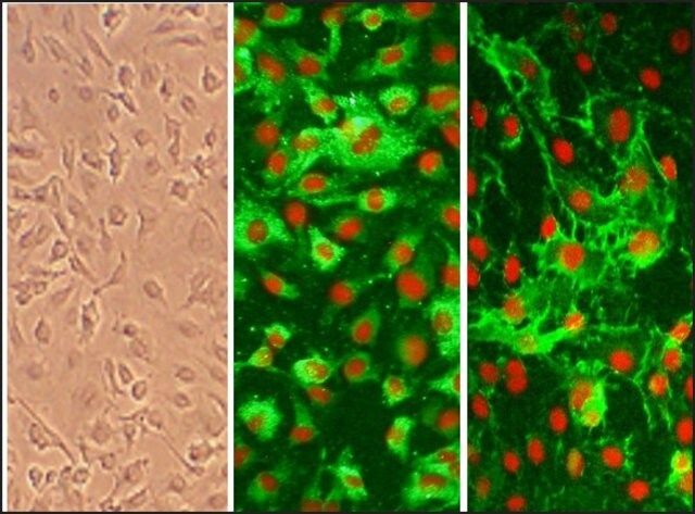 Human Internal Thoracic Artery Endothelial Cells: HITAEC, adult