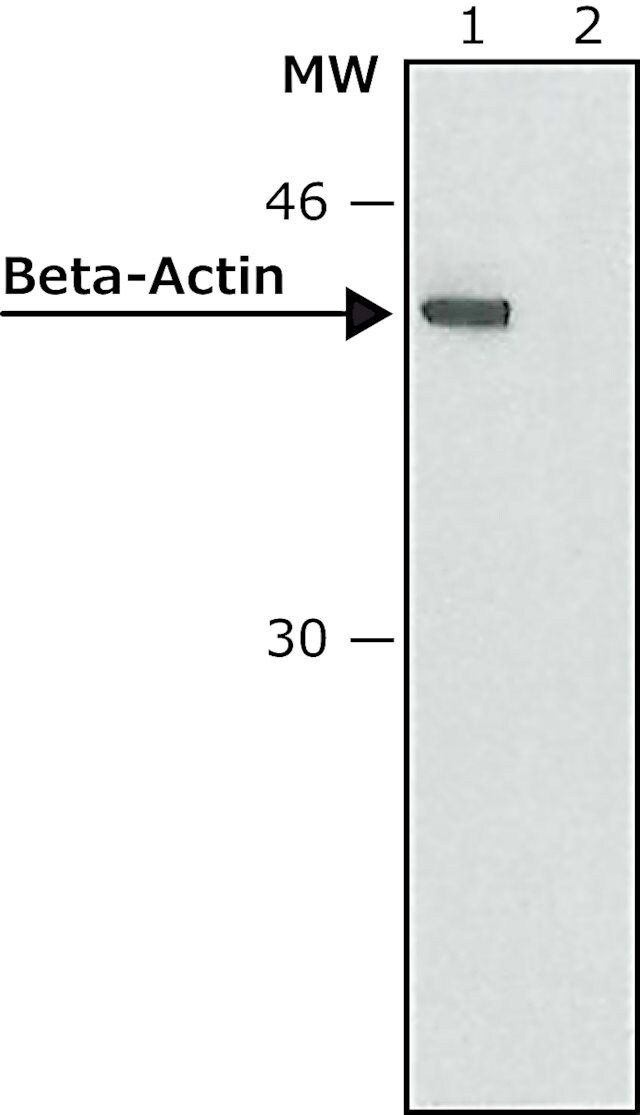 AvidinCAlkaline Phosphatase