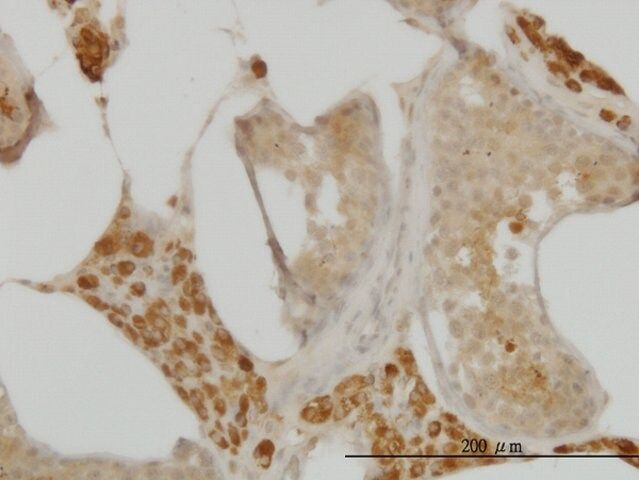 Monoclonal Anti-C10orf7 antibody produced in mouse