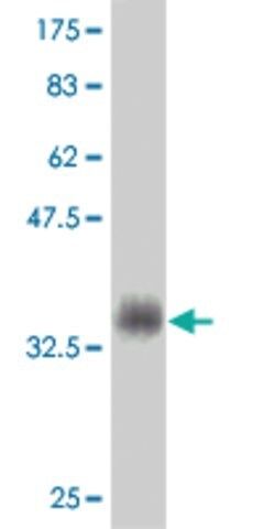 Monoclonal Anti-MSMB antibody produced in mouse