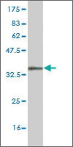 Monoclonal Anti-GTF3A antibody produced in mouse