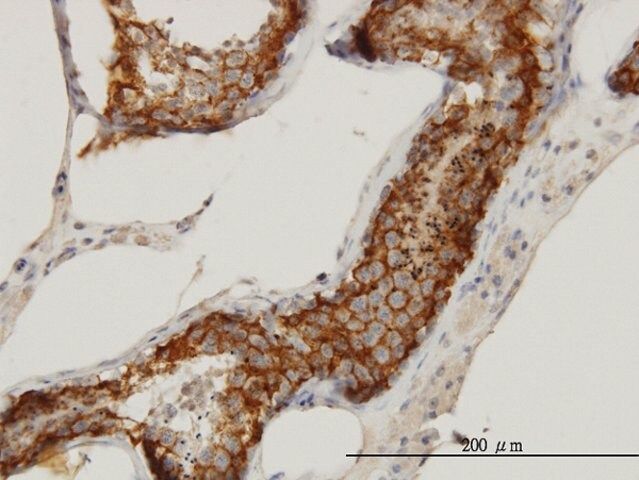 Monoclonal Anti-FATE1 antibody produced in mouse