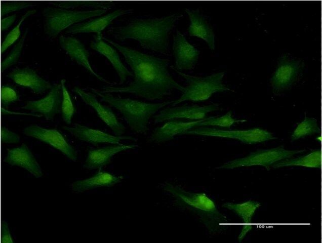 Monoclonal Anti-TSGA10 antibody produced in mouse