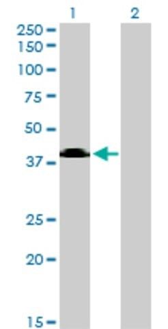 Monoclonal Anti-MGC26963 antibody produced in mouse