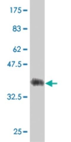 Monoclonal Anti-FLJ31951 antibody produced in mouse