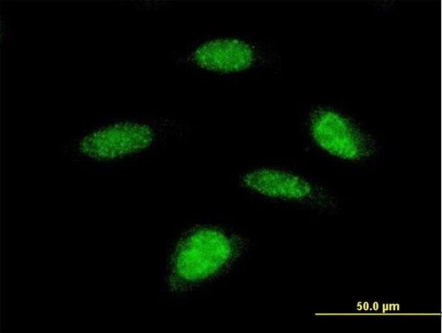 Monoclonal Anti-RPS6KB2 antibody produced in mouse