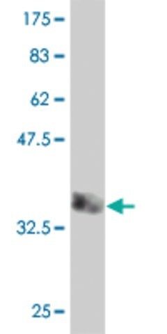 Monoclonal Anti-HERC4 antibody produced in mouse