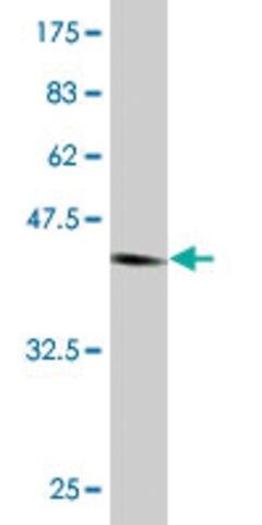 Monoclonal Anti-NUDT4 antibody produced in mouse