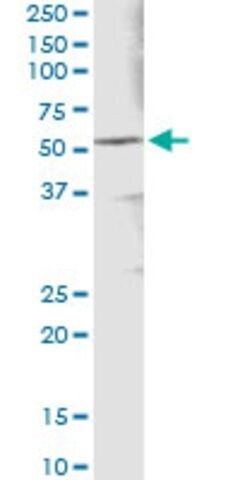 Monoclonal Anti-ALDH3A1 antibody produced in mouse