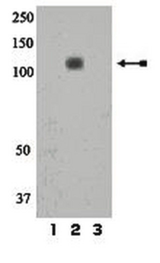 Anti-phospho-IR/IGF1R (Tyr1158) Antibody