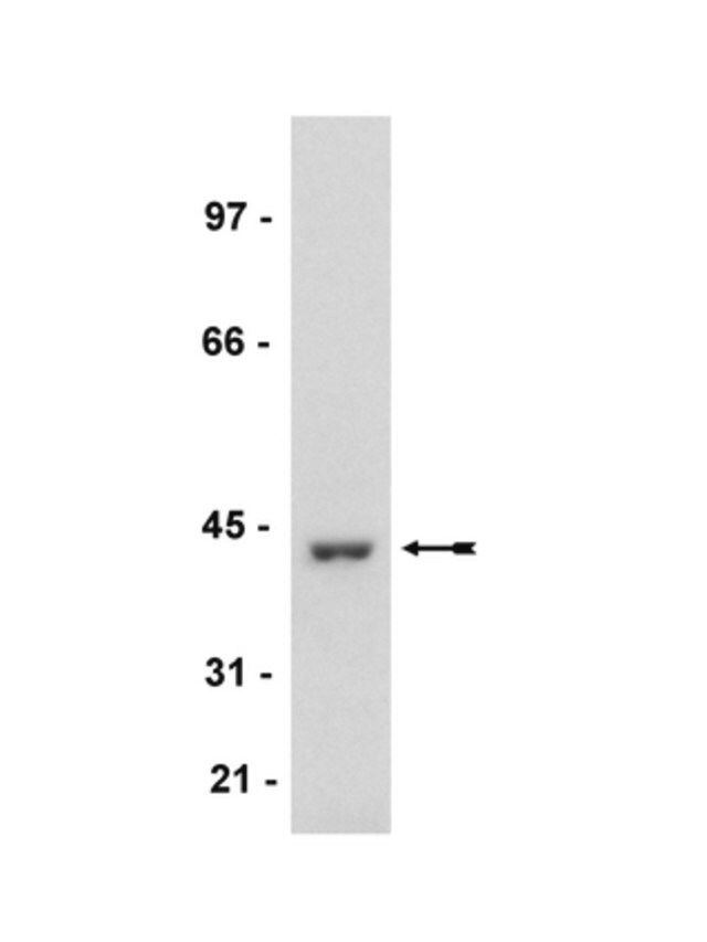 Anti-MKP1 Antibody