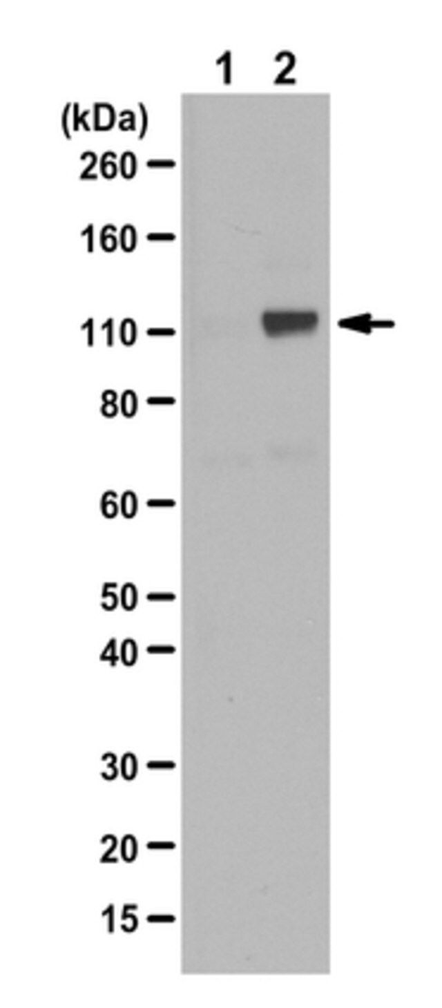 Anti-phospho-Androgen Receptor (Ser81) Antibody